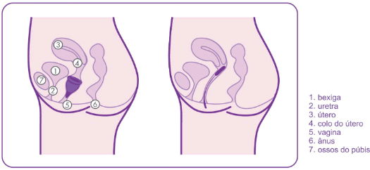 anatomia-feminina-comparao-copo-menstrual-misscup-e-absorvente-interno